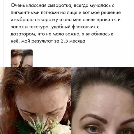 syvorotka-ot-pigmentacii-big-2